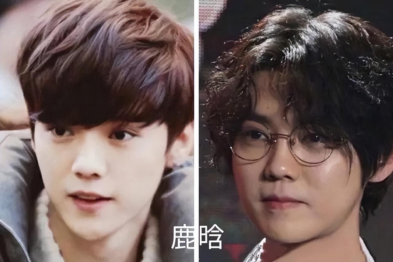 发腮和塌腮哪个更显老,发腮真的显老吗