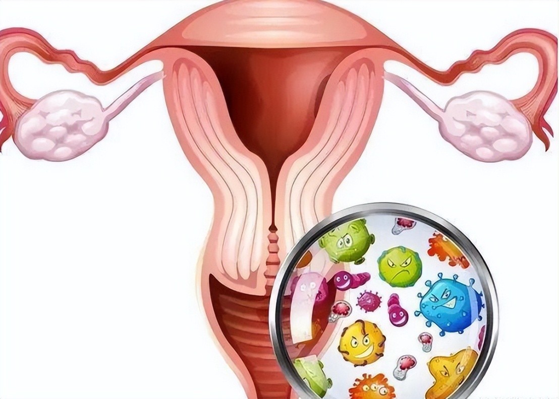 子宫性不孕症诊断与治疗,子宫发育不良性不孕确诊检查