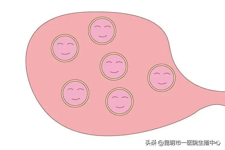 备孕五个月不怀孕如何快速怀孕,7个备孕忠告助你早日好孕