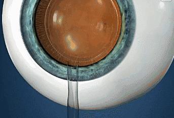 南阳南石医院近视眼手术价格表,南阳南石医院近视激光手术多少钱