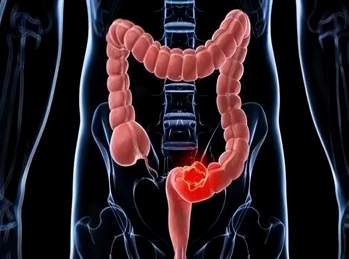 肛门瘙痒潮湿是什么原因怎么治疗,肛门周围潮湿又痒怎么治疗