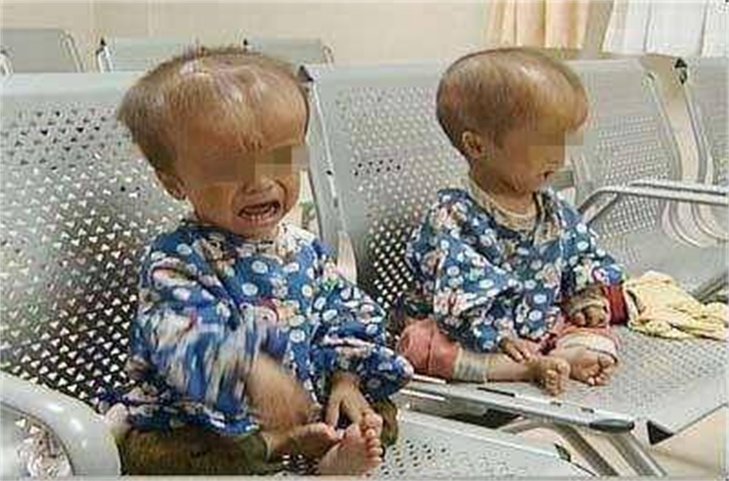 三聚氰胺奶粉事件有儿童死亡吗,三聚氰胺害死了多少人