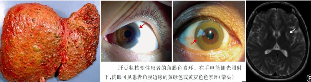 22岁月经紊乱需警惕,女性出现月经紊乱