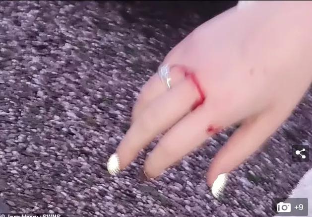 松鼠发狂咬人,松鼠疯狂咬人