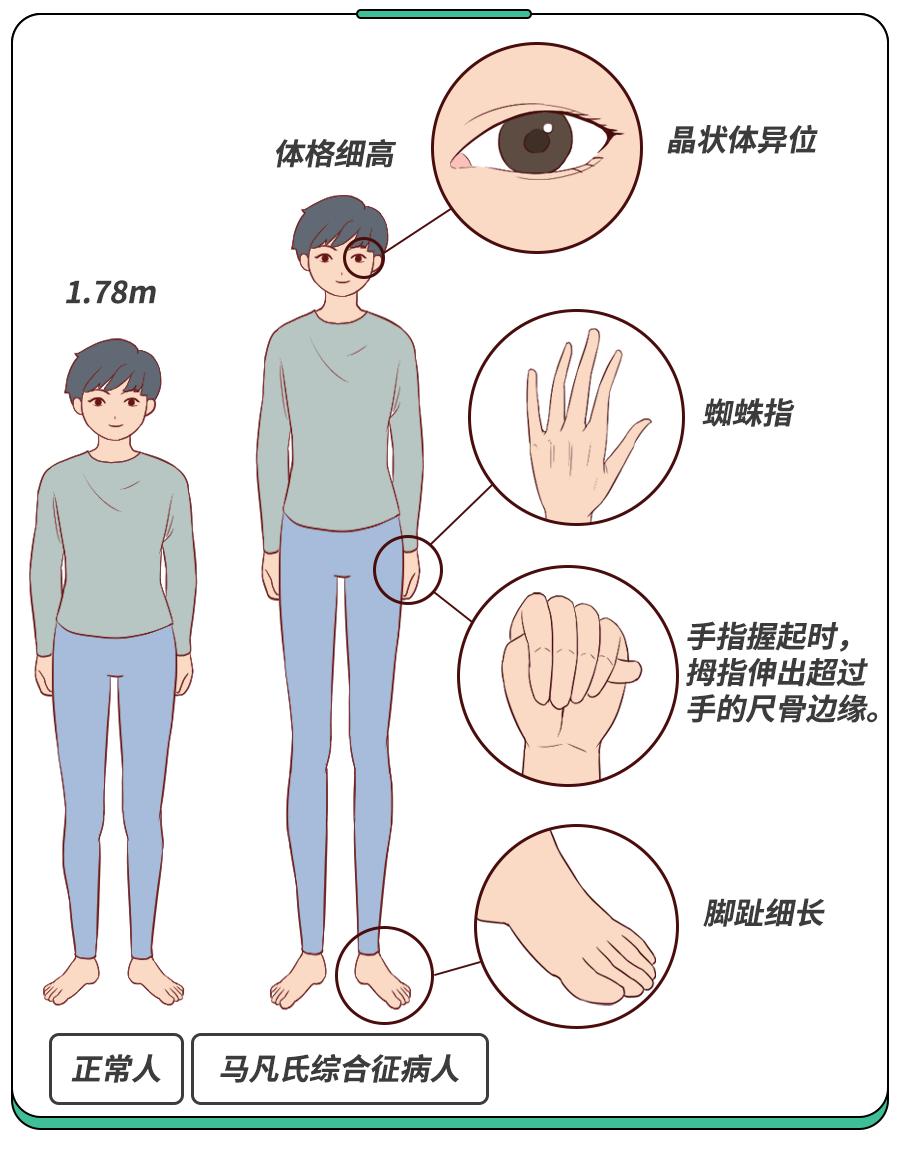 孩子早熟跟身高有关吗,孩子个子高早熟