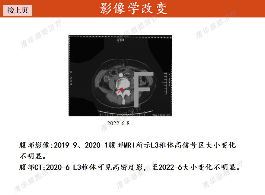 胰腺癌有突破10年的吗,一旦确诊胰腺癌还能活多久