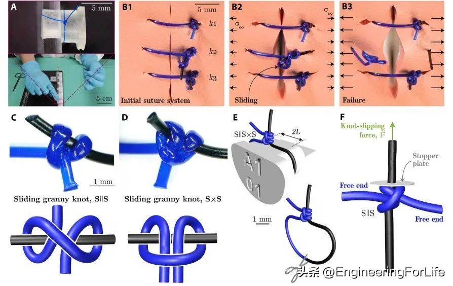 厉害了！研究“手术结”怎么打发了一篇顶刊