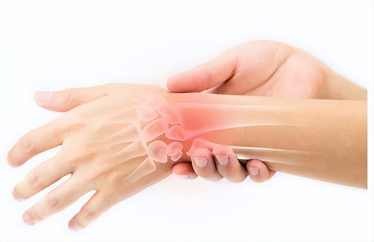 陈医生讲痛风,程凯养生说痛风急性发作时咋处理