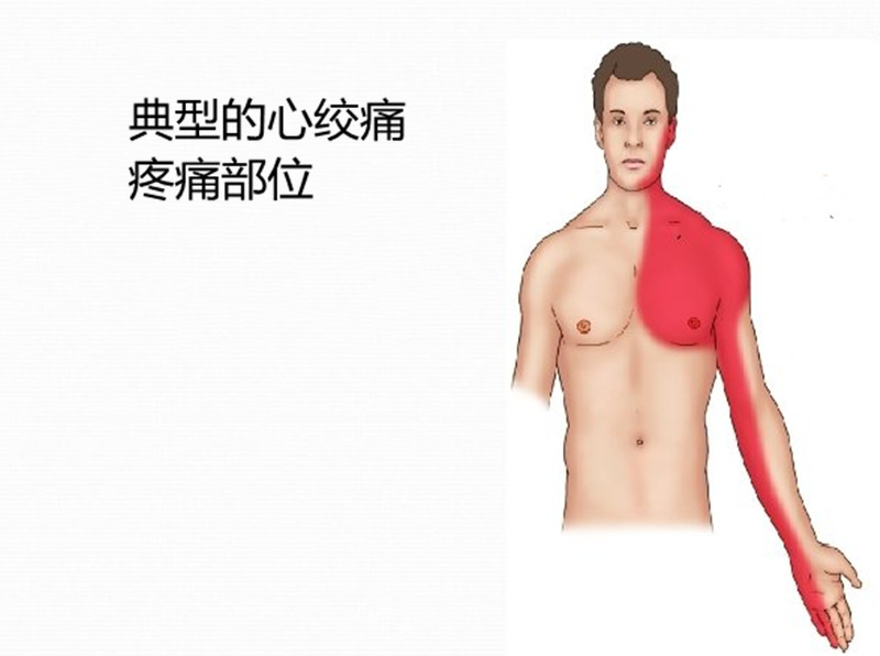 左胳膊疼痛伸不直是什么原因,左胳膊酸痛还找不到地方