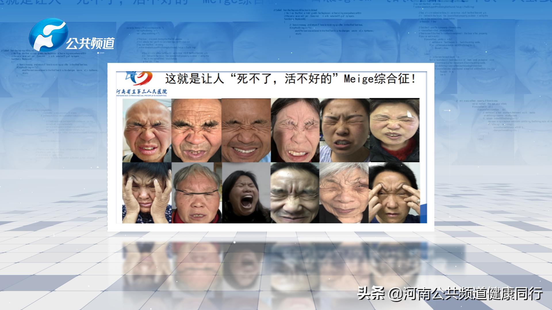 射频消融手术治疗梅杰综合征,梅杰综合征微创手术治疗