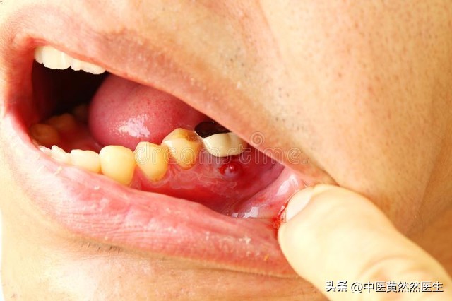 中医为什么不让多吃导滞丸,中医为什么说不能吃血