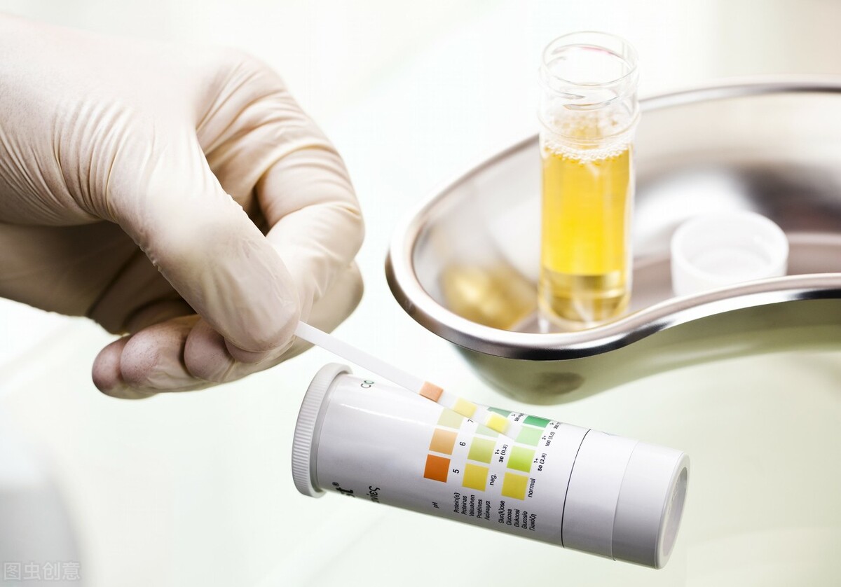 尿蛋白怎么控制才能消失,尿蛋白怎么控制不会复发