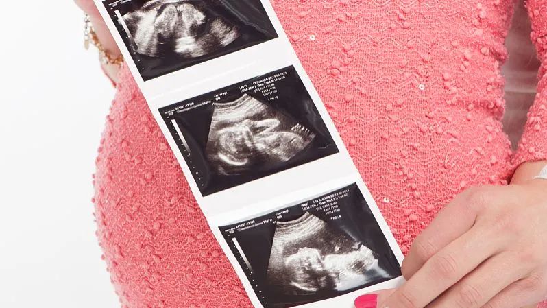 孕期超声检查，记住这些时间，轻松去产检！