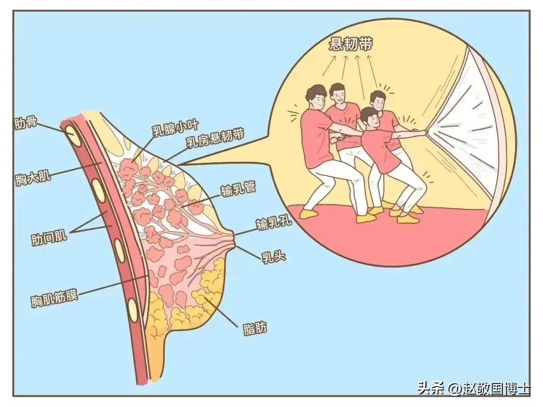 怎样预防面部下垂,如何预防胸下垂松弛