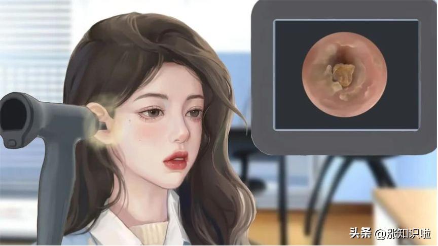 耳屎并非一无是处有3大作用,耳屎并不是耳朵的垃圾