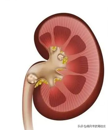 尿酸高的七个征兆官方,尿酸高都有什么前期征兆