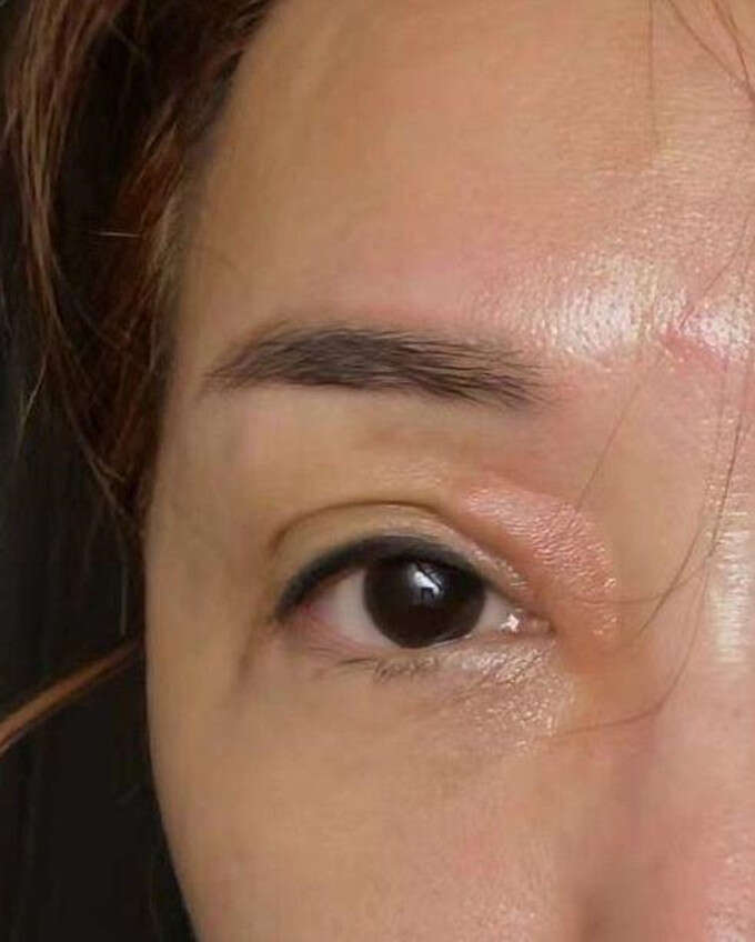 52岁港星定居东莞紧急入院！抑郁症感冒药混吃，药物敏感浑身瘙痒