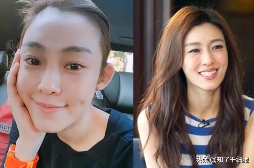 佟丽娅范玮琪张柏芝…女明星也逃不过的产后脱发，到底该咋解？