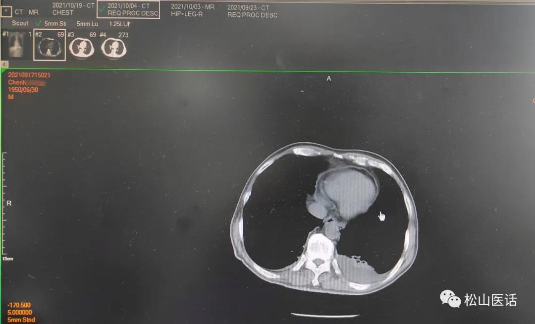 松山医话最新消息,松山医话系列之血液