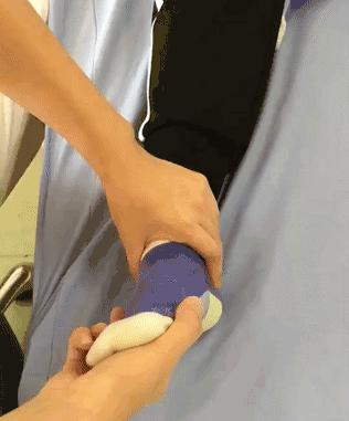 足内翻容易崴脚,足内翻多走路锻炼能减轻吗