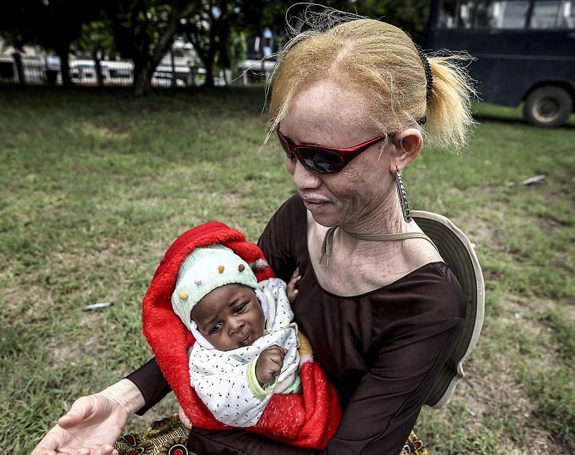 非洲版唐僧：血液堪比钻石，躯干价值126万元，警方24小时守卫