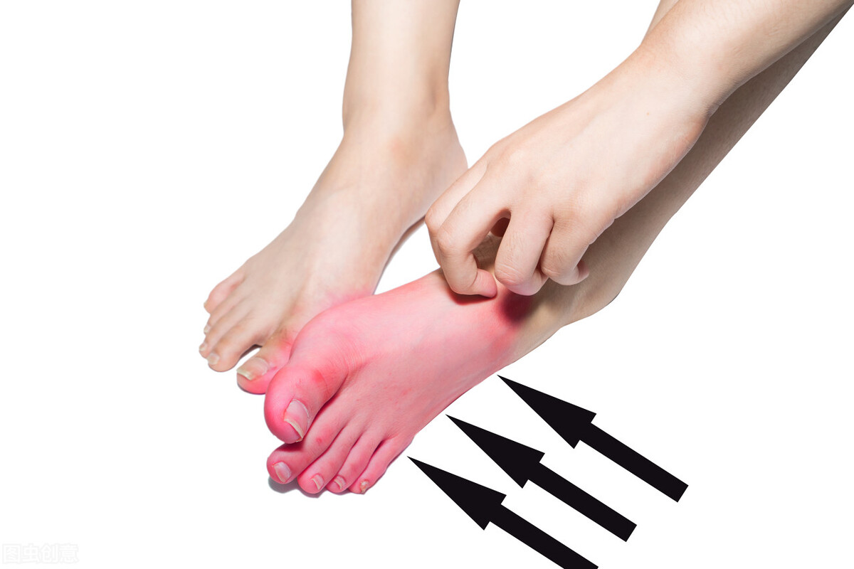 夏季皮肤瘙痒，中医怎么通过生活饮食来防治？