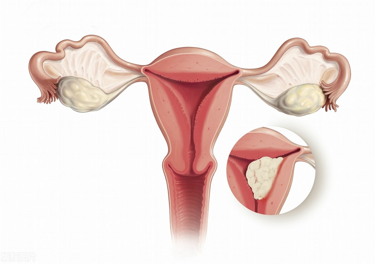 女人没有阴道会怎么样?究竟与正常女性有什么区别?医生告诉你