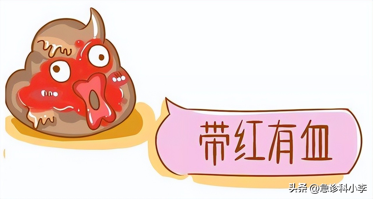 肠道为什么反复长息肉如何预防,如果肠道长息肉身体会有哪些反应