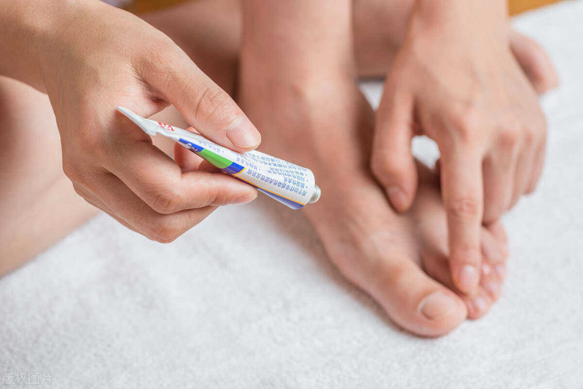 生姜治疗扁平疣有效吗,梁医生治疗扁平疣