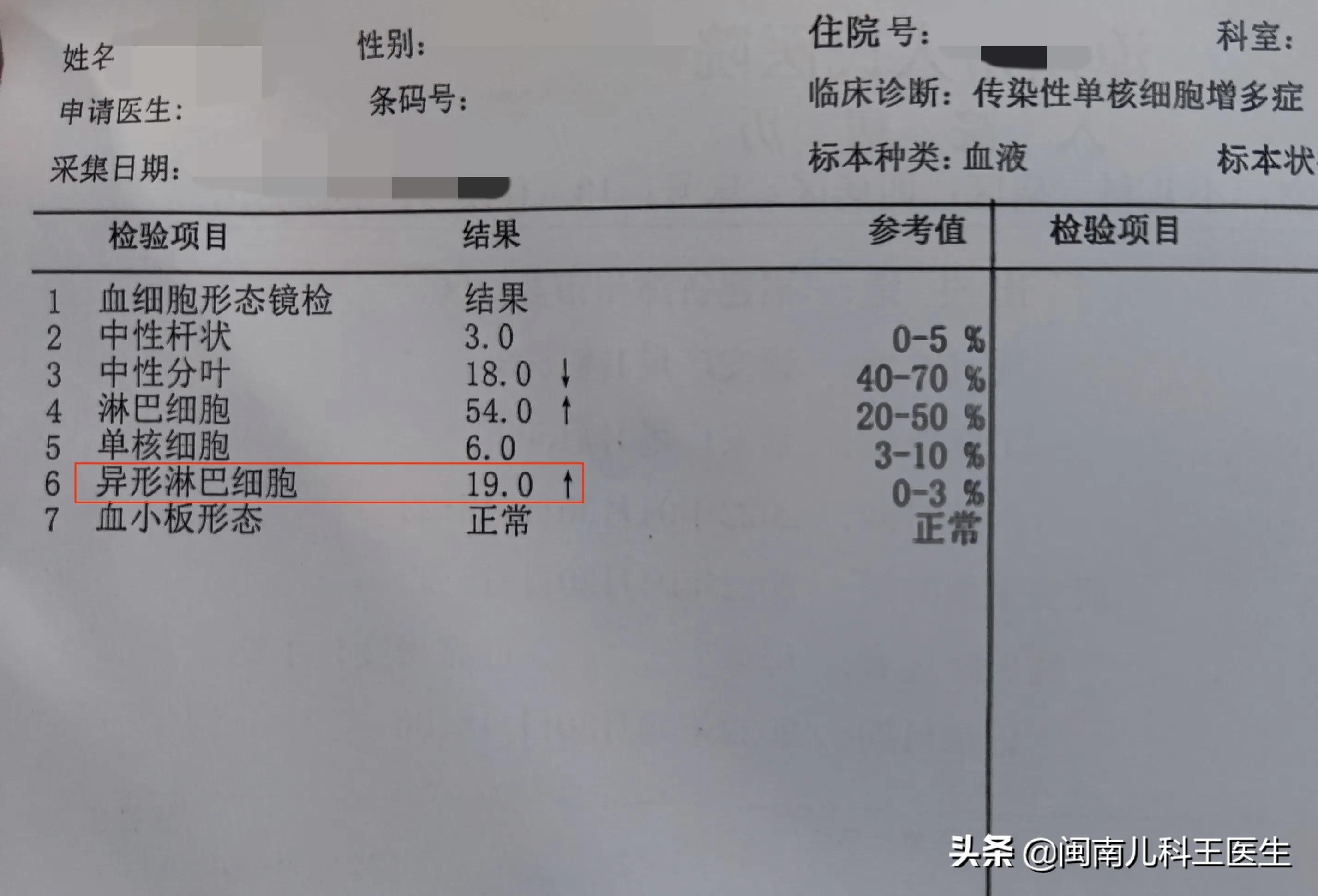 儿童扁桃体三度肿大会有什么影响,扁桃体发炎单核细胞高怎么办