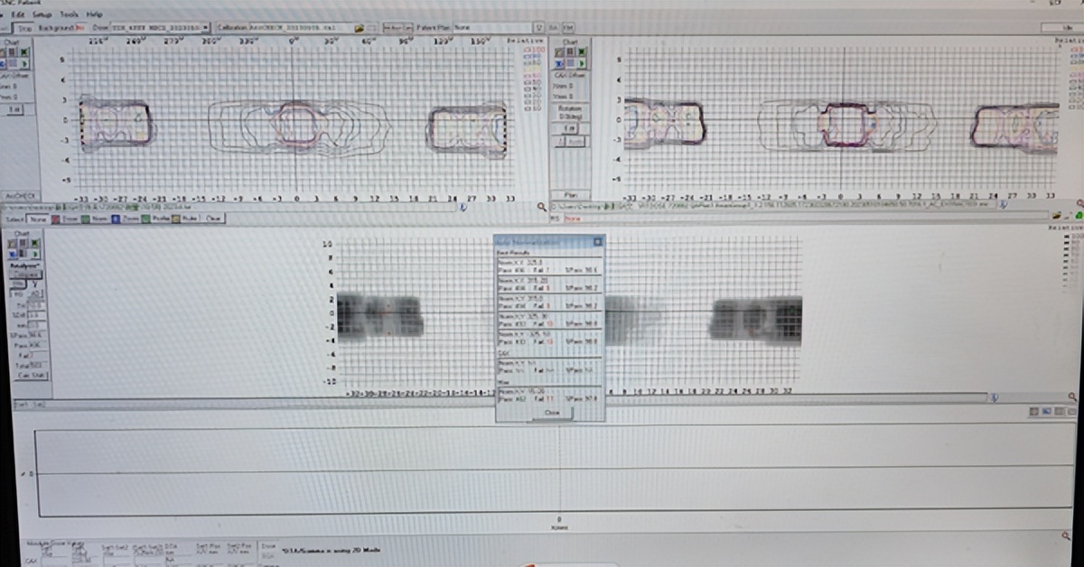威海市立医院肿瘤医院,威海市立医院肝癌介入手术