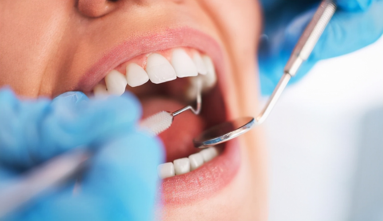 牙科陷阱,去牙科避免哪些坑