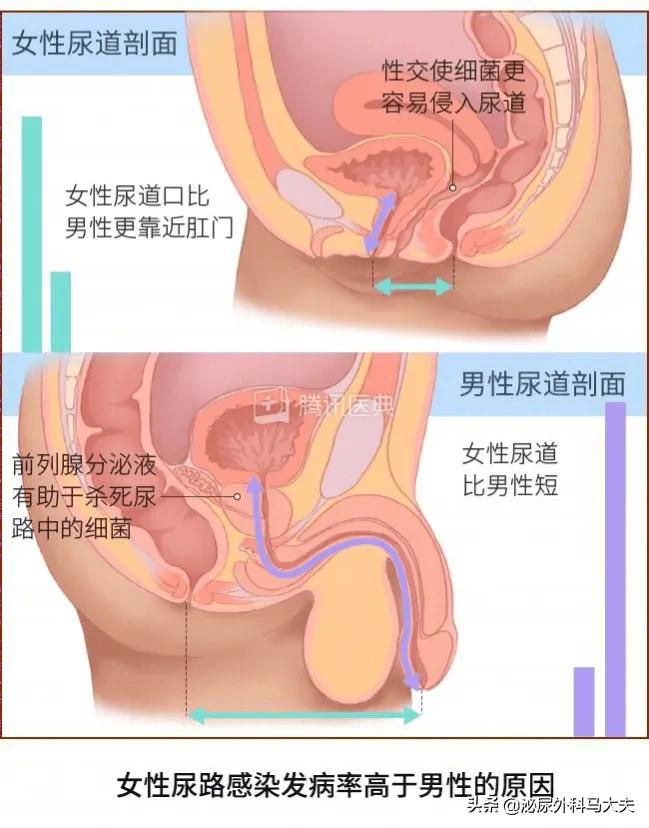 绝经妇女尿路感染吃什么药,绝经女性会频繁尿路感染吗