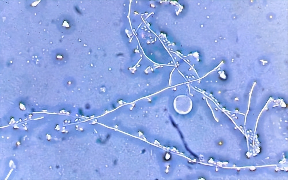 金黄色葡萄球菌的微生物特性,金黄色葡萄球菌的培养特性