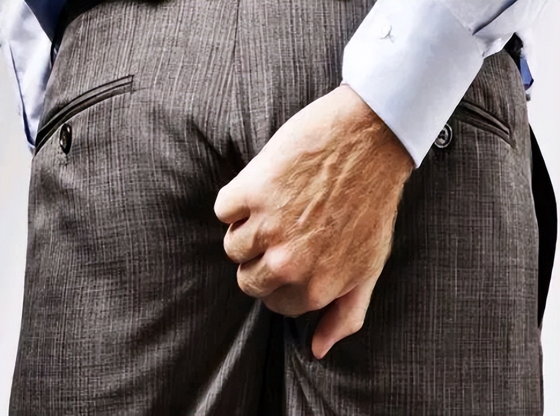 肛门瘙痒潮湿是什么原因怎么治疗,肛门周围潮湿又痒怎么治疗