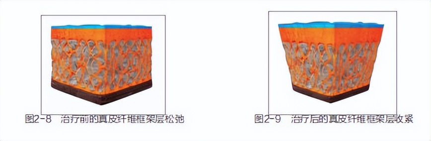 做热玛吉紧肤除皱多少钱,热玛吉紧肤祛皱需要多少钱