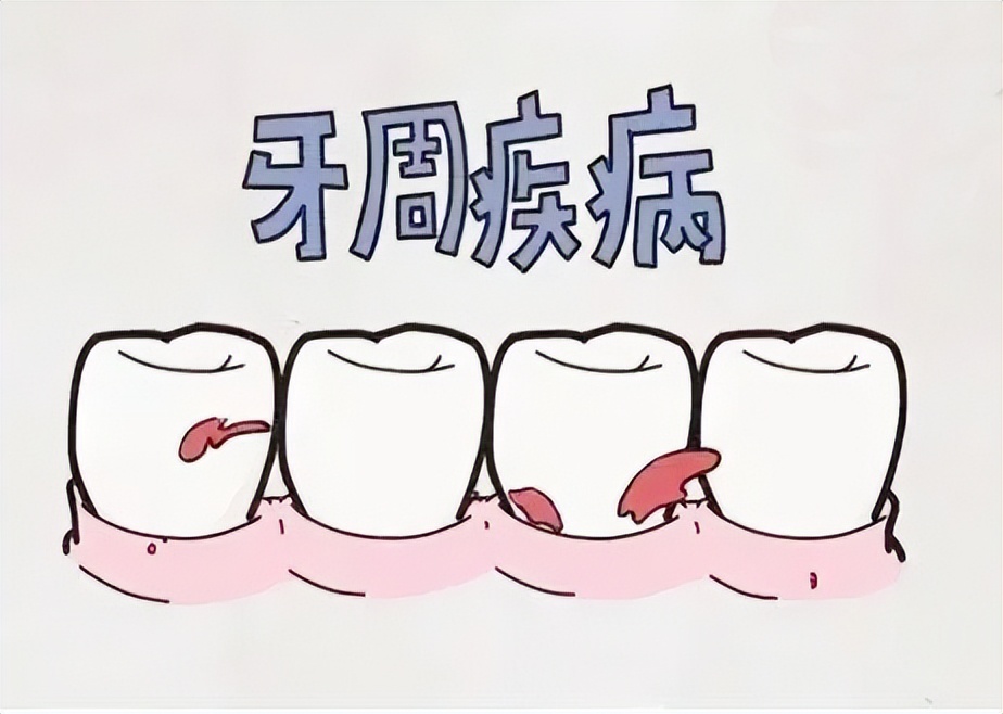 认识牙齿保护牙齿,认识牙齿预防蛀牙课件