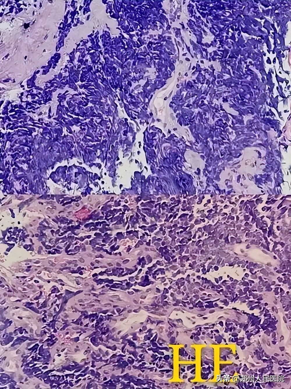 切片？捞片？烤片？听着你像在做菜，你却说在“破案”！