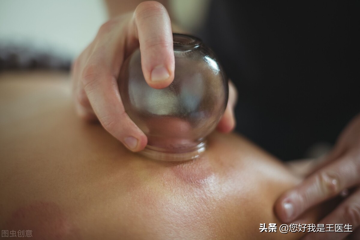 脖子疼怎么拔罐,脖子痛拔罐哪几个地方最好啊