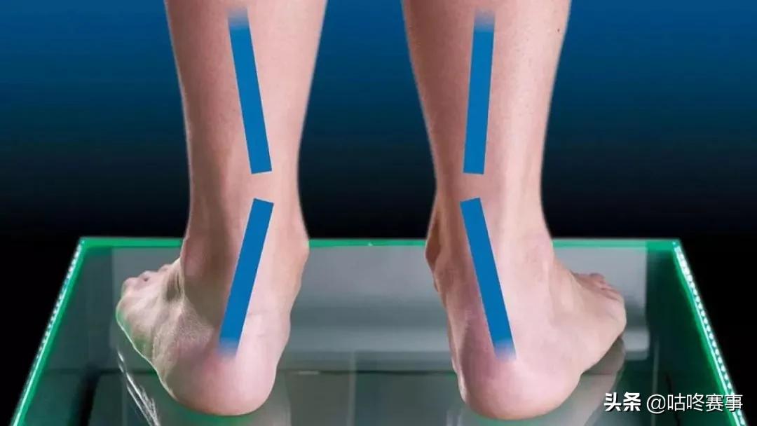 马拉松跑者足底筋膜炎,足底筋膜炎跑步治好