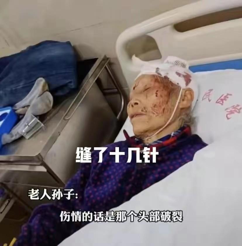 除夕夜儿媳殴打83岁婆婆，倒地后被丈夫一脚踢开，目前未脱离危险