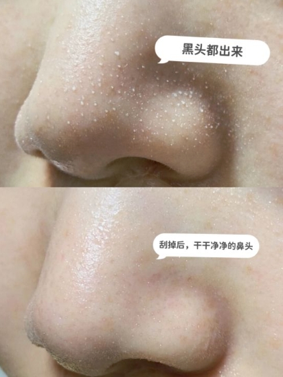 国产抗老护肤品推荐百雀羚,护肤品排行榜前十名国货百雀羚