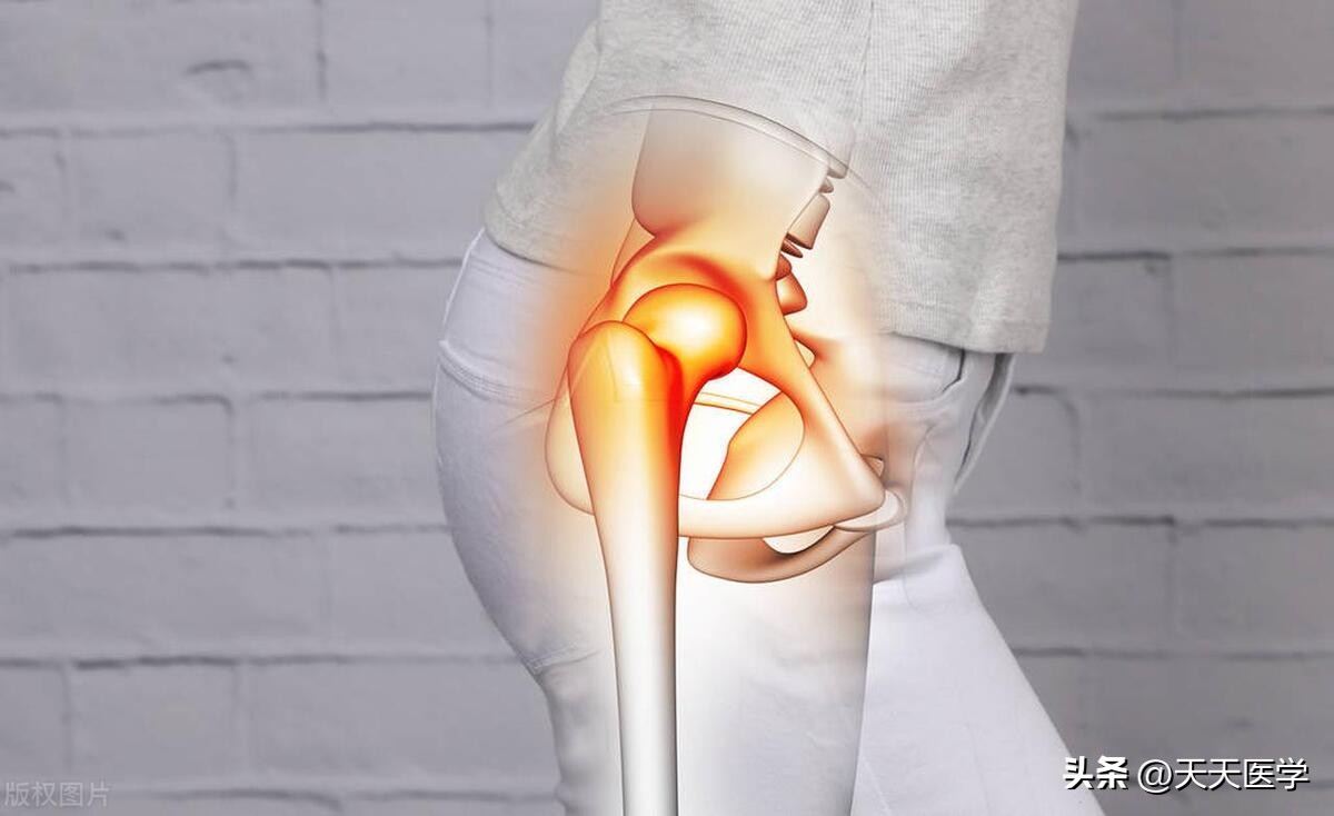 膝关节穿刺的适应症及穿刺方法,关节穿刺术适用部位