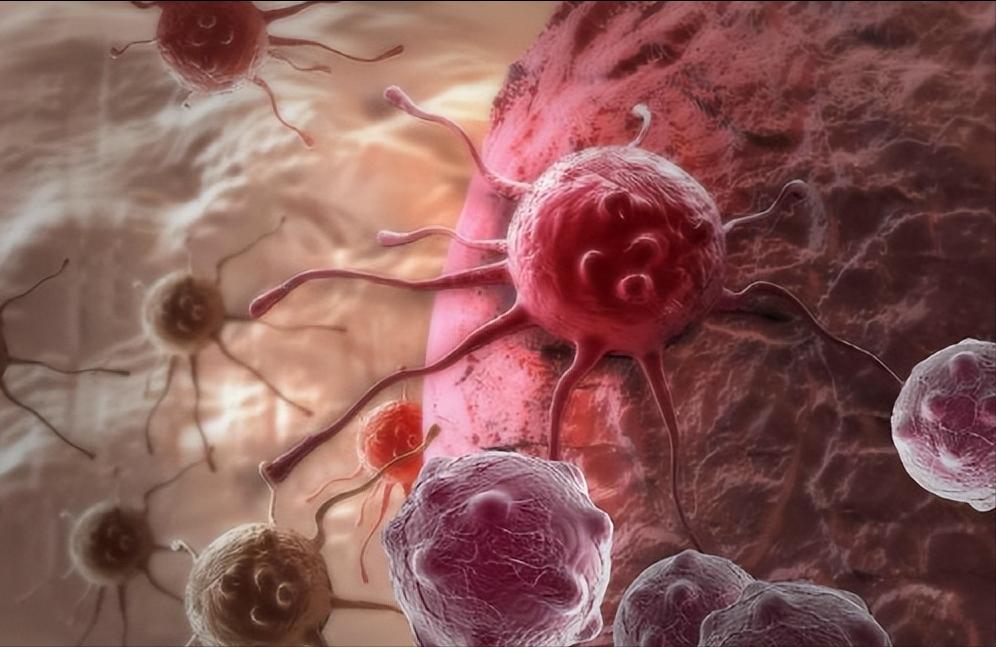 避免结节发展到癌应该多吃什么,不使结节变癌的几种不能吃的食物