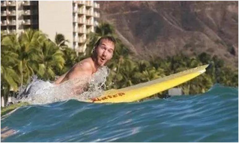 没有四肢的人中国,没有四肢人可以活吗