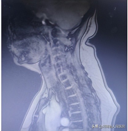 一小时，让她卸下背了十余年的“包袱”