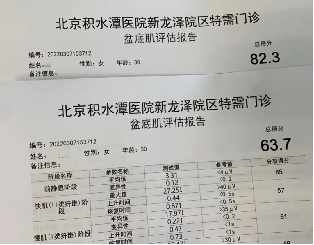 盆底康复训练效果,盆底康复治疗仪器哪个品牌的好