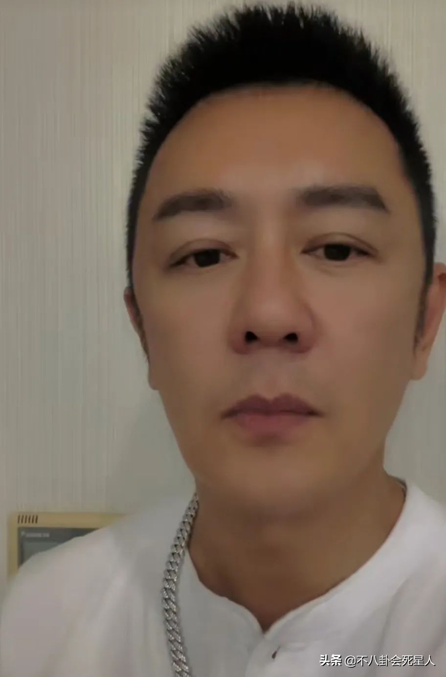 景甜悲伤蛙双眼皮照片,明星割双眼皮前后对比图