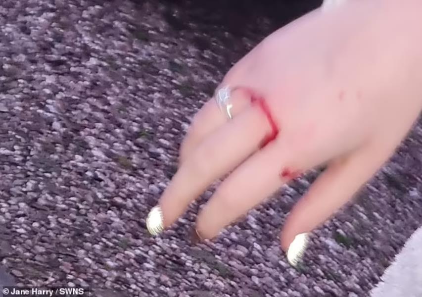 英国嗜血松鼠2天咬伤18人咬到出血!最终被抓起来安乐死