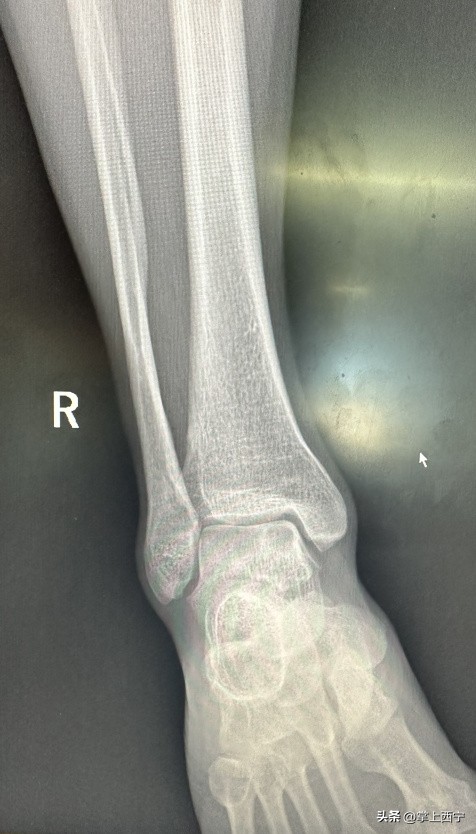 西宁市第三人民医院外科,西宁第三人民医院扩建项目